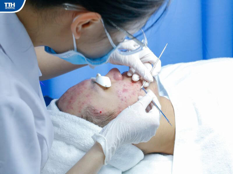 3 lý do bạn nên lựa chọn điều trị mụn trứng cá tại Bệnh viện Đa khoa TTH Vinh