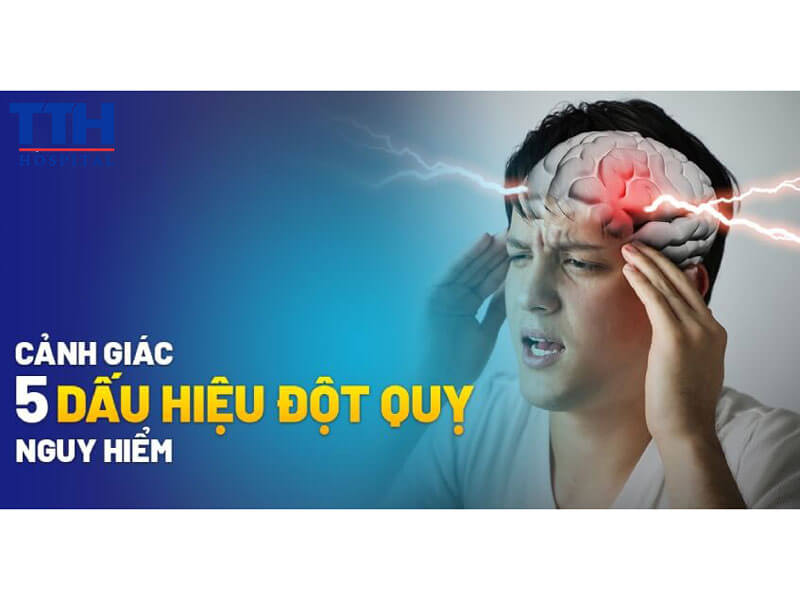 5 dấu hiệu cảnh báo sớm của cơn đột quỵ