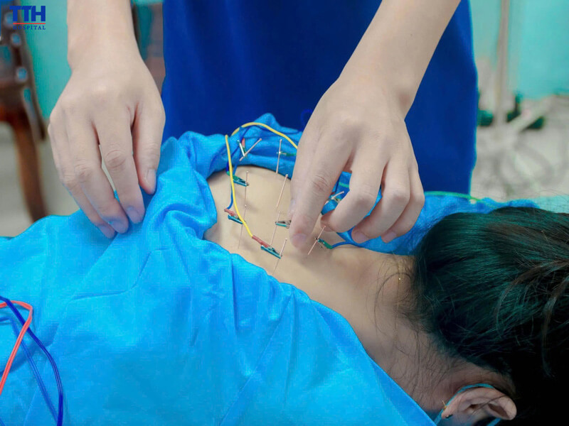 Các phương pháp trị liệu chính