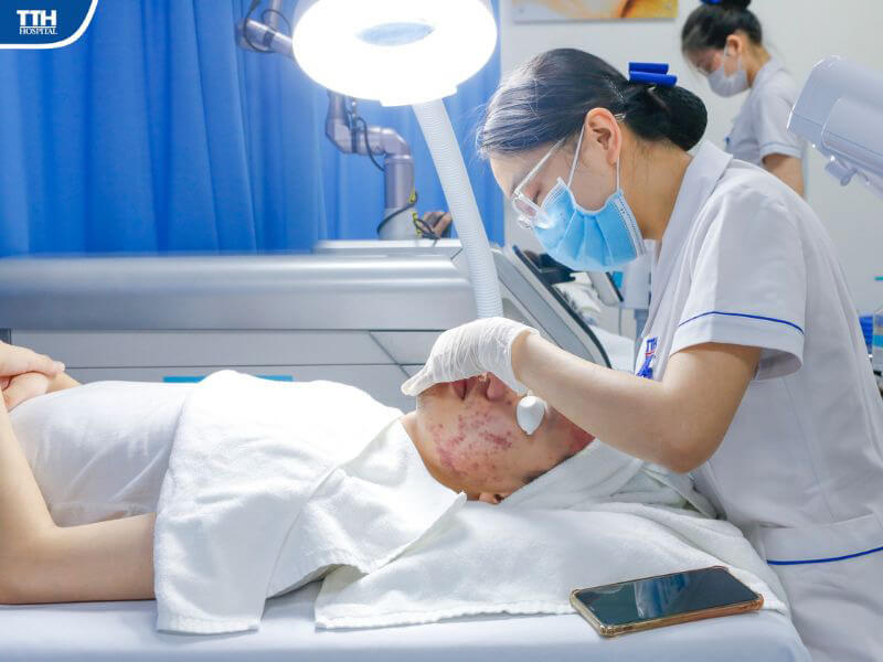 Điều trị mụn trứng cá tại Khoa Da liễu Bệnh viện Đa khoa TTH Vinh