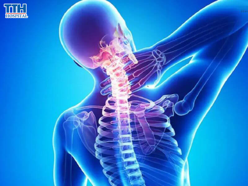 Một số cách điều trị thoái hóa cột sống cổ phổ biến