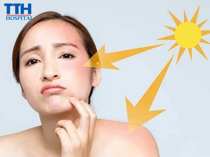 Những nhân tố ảnh hưởng xấu đến làn da vào mùa hè