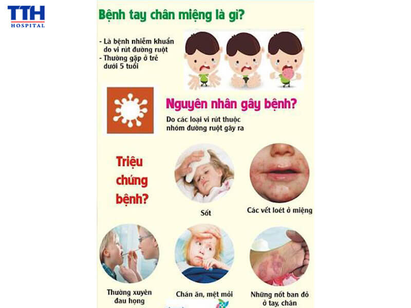 Phòng chống bệnh chân tay miệng tại trẻ
