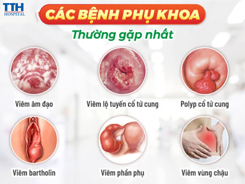 Phụ nữ hiện đại không ngại khám phụ khoa