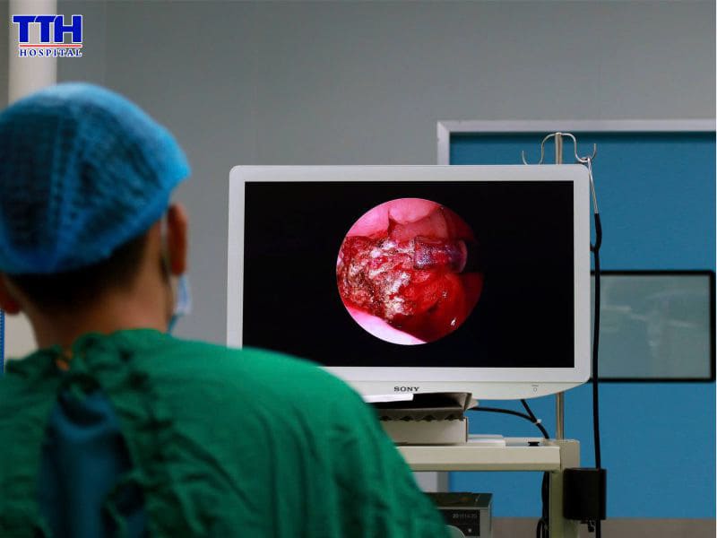 Cắt Amidan và Nạo VA bằng công nghệ Plasma
