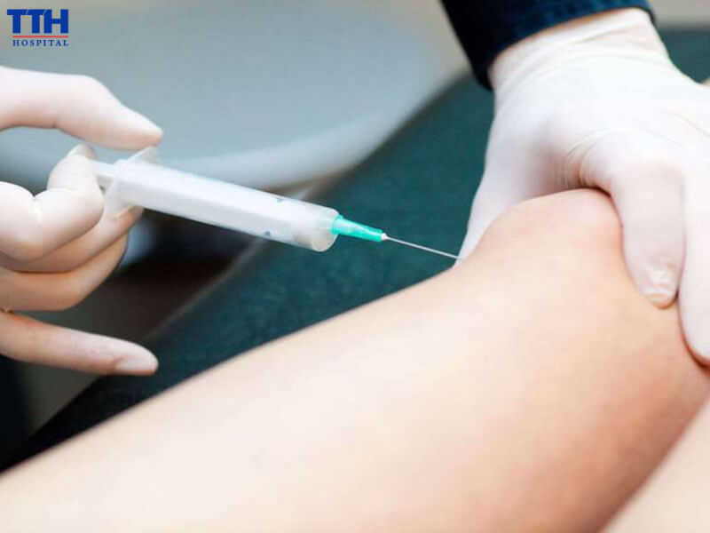 Tiêm nội khớp là phương pháp đưa thuốc trực tiếp vào ổ khớp bằng kim tiêm chuyên dụng