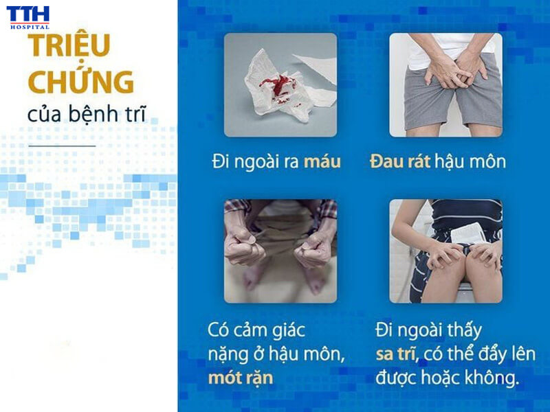 Triệu chứng thường gặp của bệnh trĩ