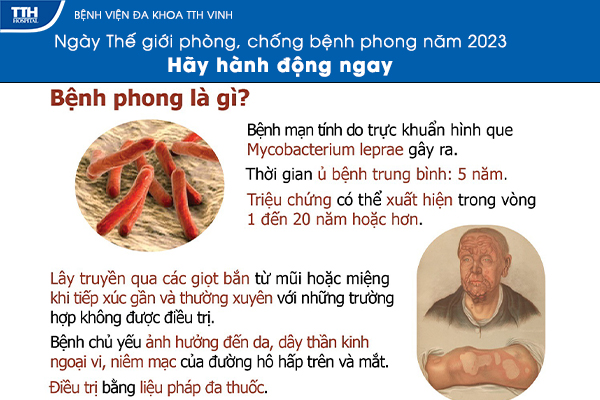 Bệnh phong là gì và những điều cần lưu ý