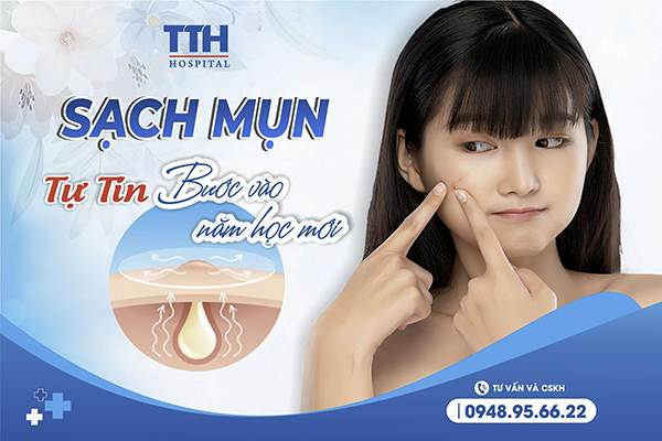 Điều trị mụn ở lứa tuổi học sinh