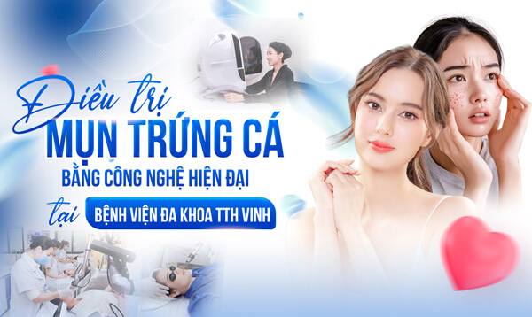 Điều trị mụn trứng cá bằng công nghệ hiện đại tại TTH Vinh