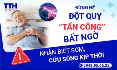 Đừng để đột quỵ “tấn công” bật ngờ