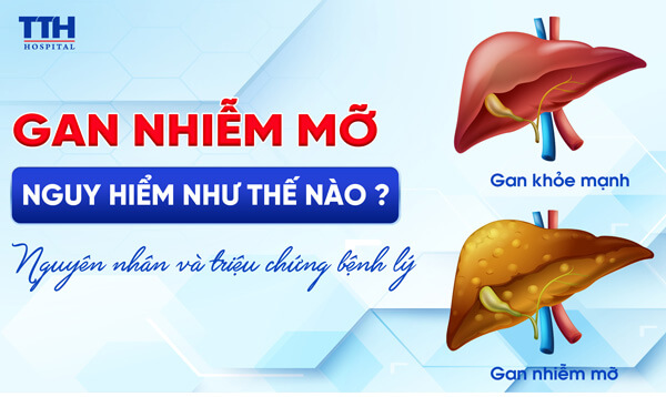 Gan nhiễm mỡ nguy hiểm như thế nào? Nguyên nhân và triệu chứng bệnh lý