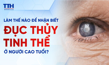 Làm thế nào để nhận biết đục thủy tinh thể ở người cao tuổi?