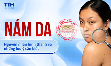 Nám da: Nguyên nhân hình thành và những lưu ý cần biết