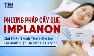Phương pháp cấy que Implanon