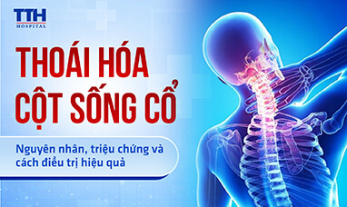 Thoái hóa cột sống cổ: Nguyên nhân, triệu chứng và cách điều trị hiệu quả