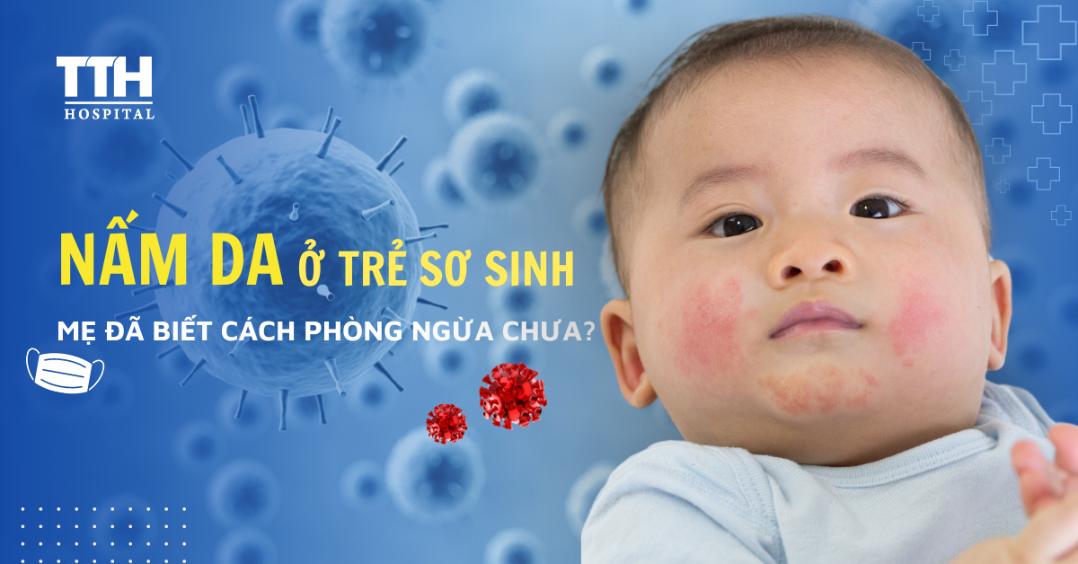 Nấm Da Ở Trẻ Sơ Sinh: Mẹ Đã Biết Cách Phòng Ngừa Chưa?