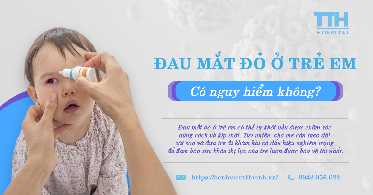 Đau Mắt Đỏ Ở Trẻ Em: Có Nguy Hiểm Không? Nguyên Nhân Và Cách Chăm Sóc Hiệu Quả