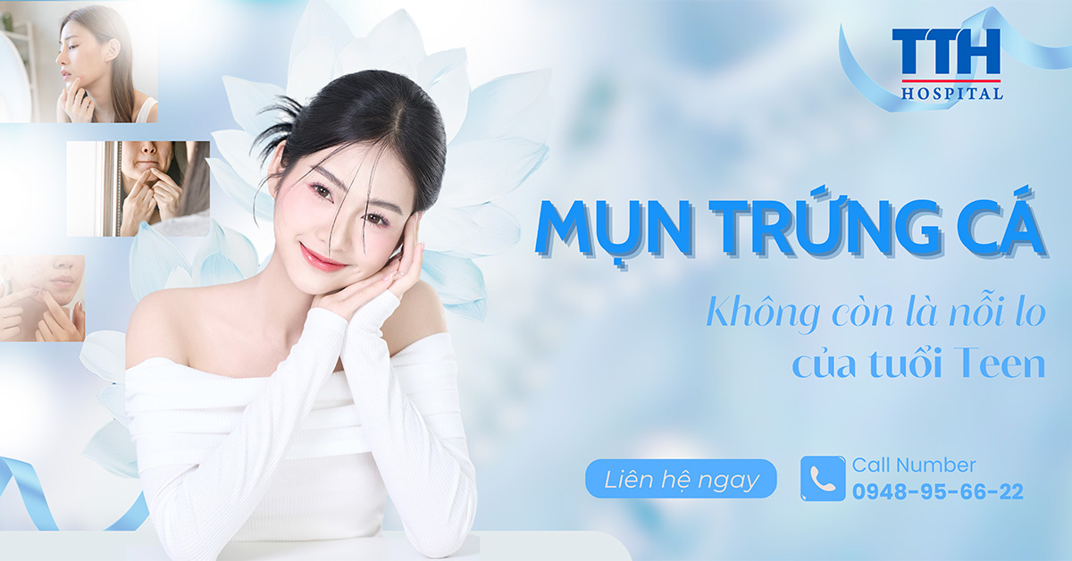 Mụn Trứng Cá Không Còn Là Nỗi Lo Của Tuổi Teen