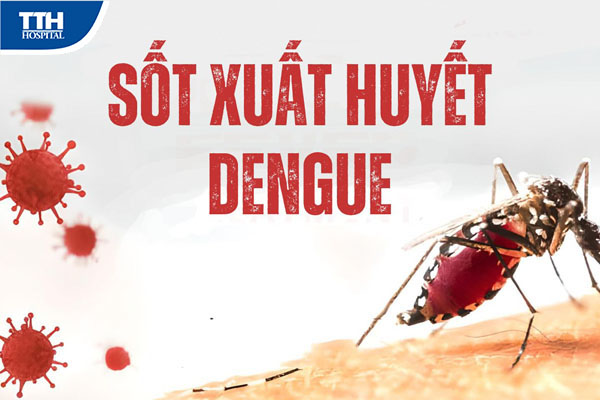 3. Triệu chứng của sốt xuất huyết