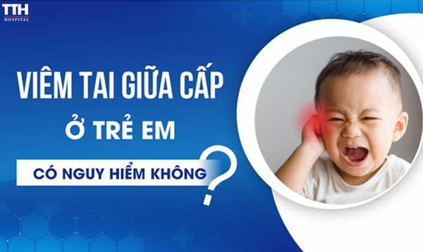 Viêm tai giữa ở trẻ em: Nguyên nhân, dấu hiệu nhận biết và cách điều trị hiệu quả